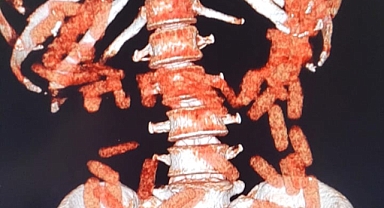 Kayseri'de Uyuşturucu Ticareti Yapan İki Şahıs Tutuklandı