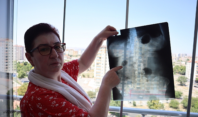 22 yıldır karnında ameliyat iğnesiyle yaşıyor